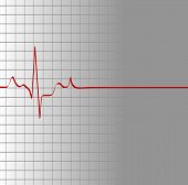 picture of dead-line  - grid with heart beat and then flatline  - JPG 